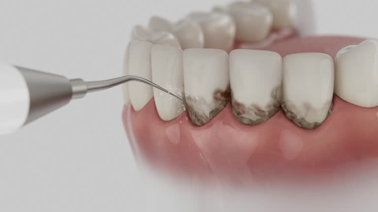 Trusted Teeth Cleaning And Checkup service in Portsmouth, VA - Dentist Open Now